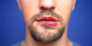 Feminisation
